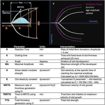 A Possible Role of Amyloidogenic Blood Clotting in the Evolving Haemodynamics of Female Migraine-With-Aura: Results From a Pilot Study